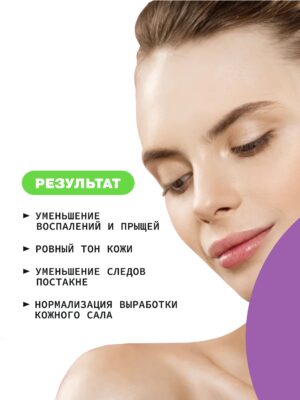 Крем-гель анти-акне для проблемной кожи с ниацинамидом и цинком ART&FACT