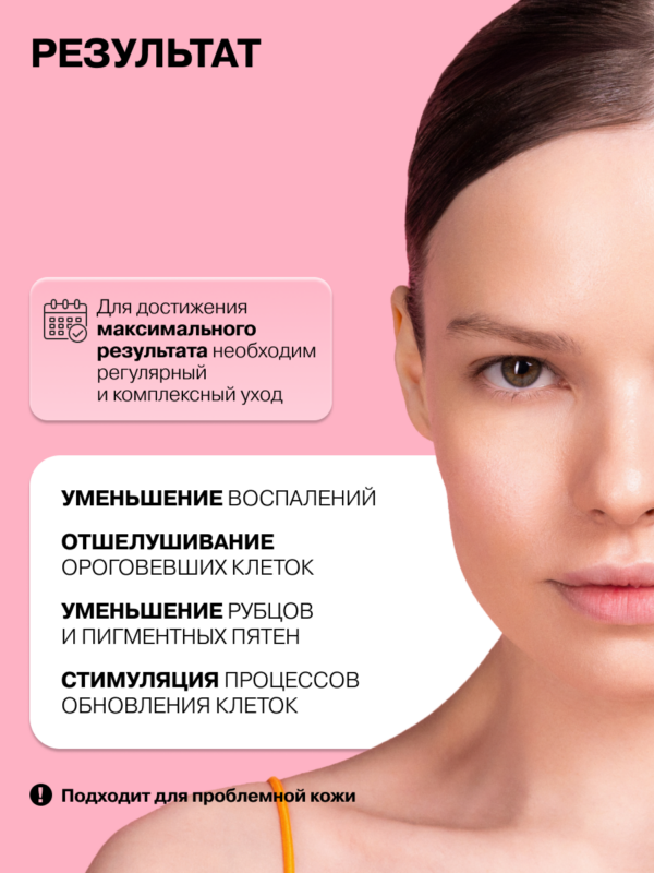Сыворотка для лица с азелаиновой кислотой 10% против воспалений и прыщей