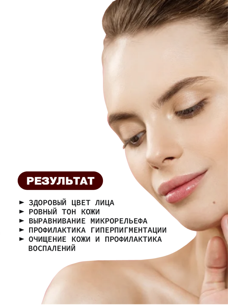 "Кровавый" пилинг для лица с молочной кислотой 22%, гликолевой кислотой ...